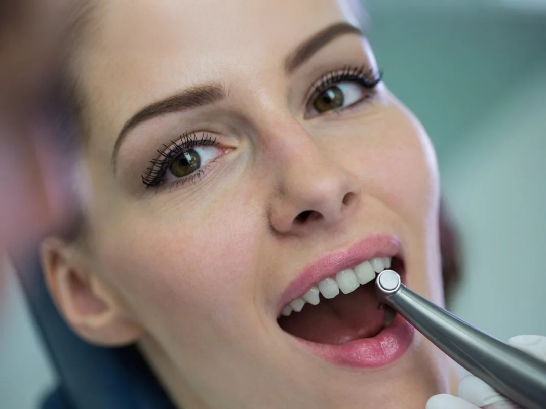 Say Goodbye to Cavities with A.C.E. Technology